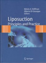 LiposuctionPrinciplesandPractice_Shiffman_DiGiuseppeAlberto